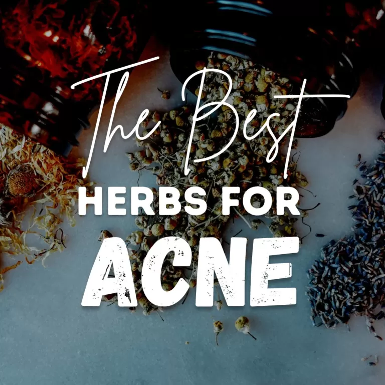 The Best Herbs for Acne Prevention and Treatment